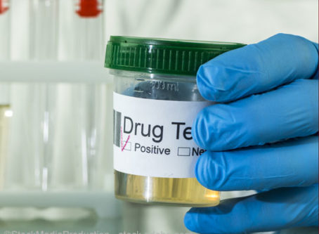 drug test urine sample