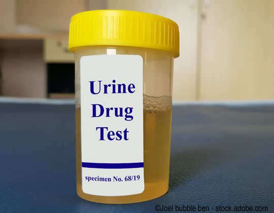 drug and alcohol testing drug test