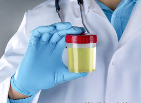 Urine sample for drug testing